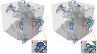 Detection of toric grains allows to remove surface patches in pore space's skeleton